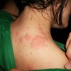 В Капитан Андреево бедстват заради нашествие от комари